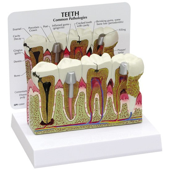 Teeth (Healthy/Pathologies)