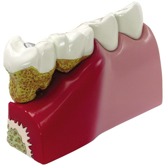 Teeth (Healthy/Pathologies)