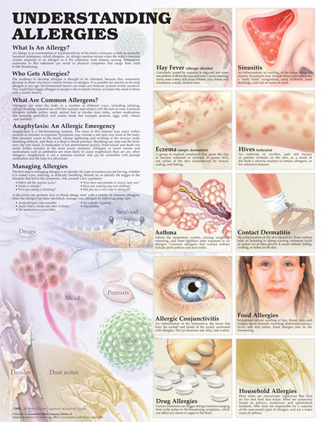 understanding-allergies2e_1__24677.1589753239.1280.1280.jpg