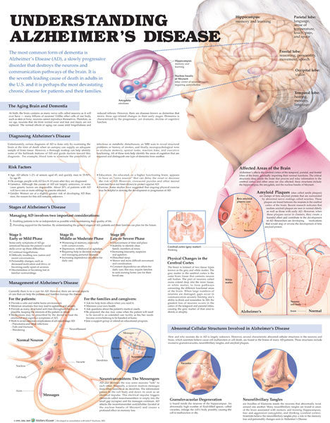 understanding-alzheimers-2e_1__23507.1589753023.1280.1280.jpg