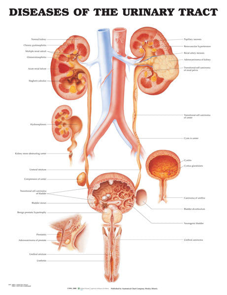 urinary-tract-disorders__63484.1589753383.1280.1280.jpg