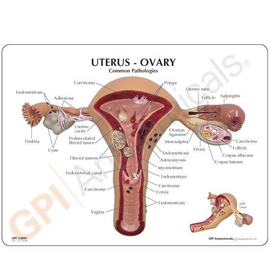Uterus/Ovary