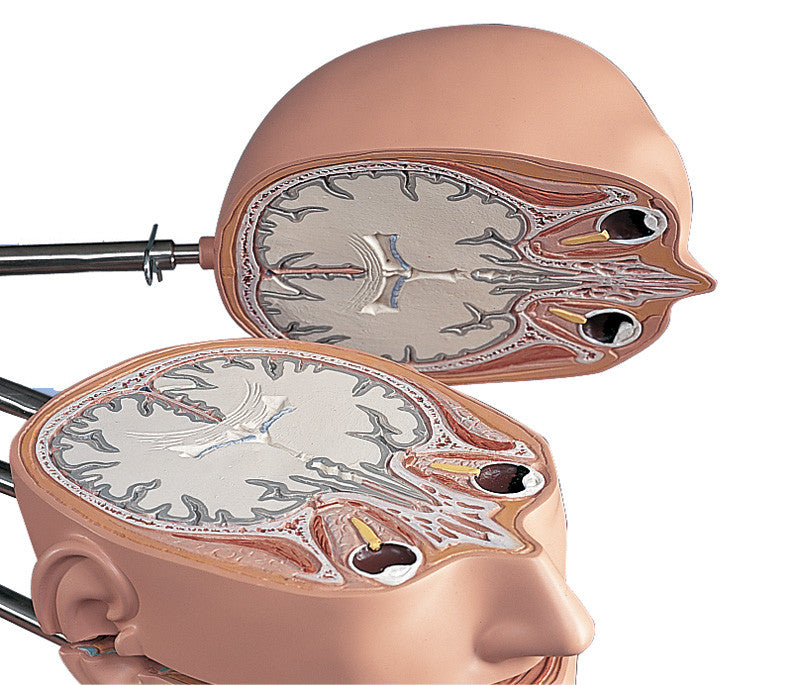 MRI Disc Torso Model with 15 Transverse Sections