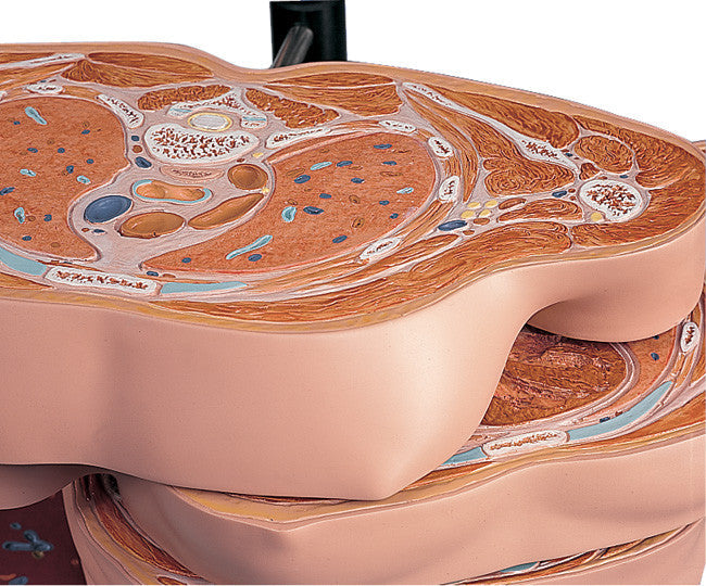 MRI Disc Torso Model with 15 Transverse Sections