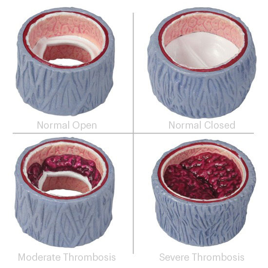 4-Piece Vein model