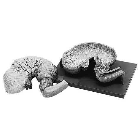 Stomach of the Horse Somso Zo 36