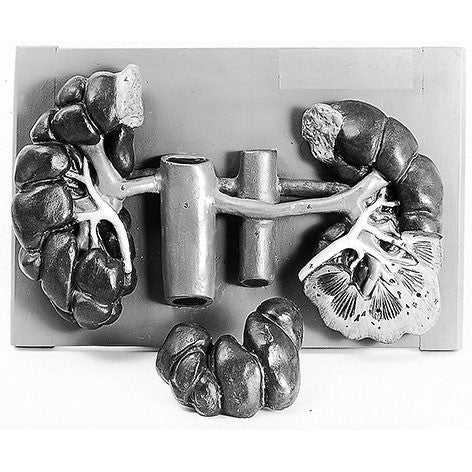 Kidneys of the Cow Somso Zo 7