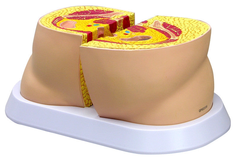 Obesity Model - GPI 3600