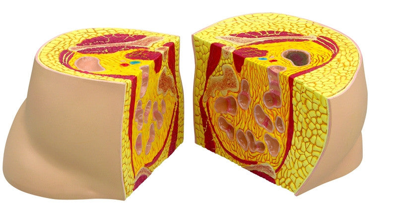 Obesity Model - GPI 3600 - cross section comparison