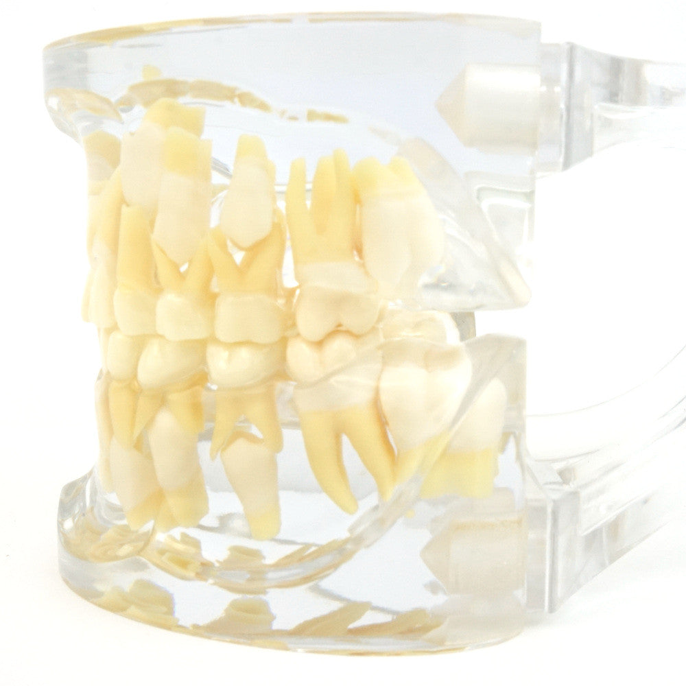 Mixed Dentition Model
