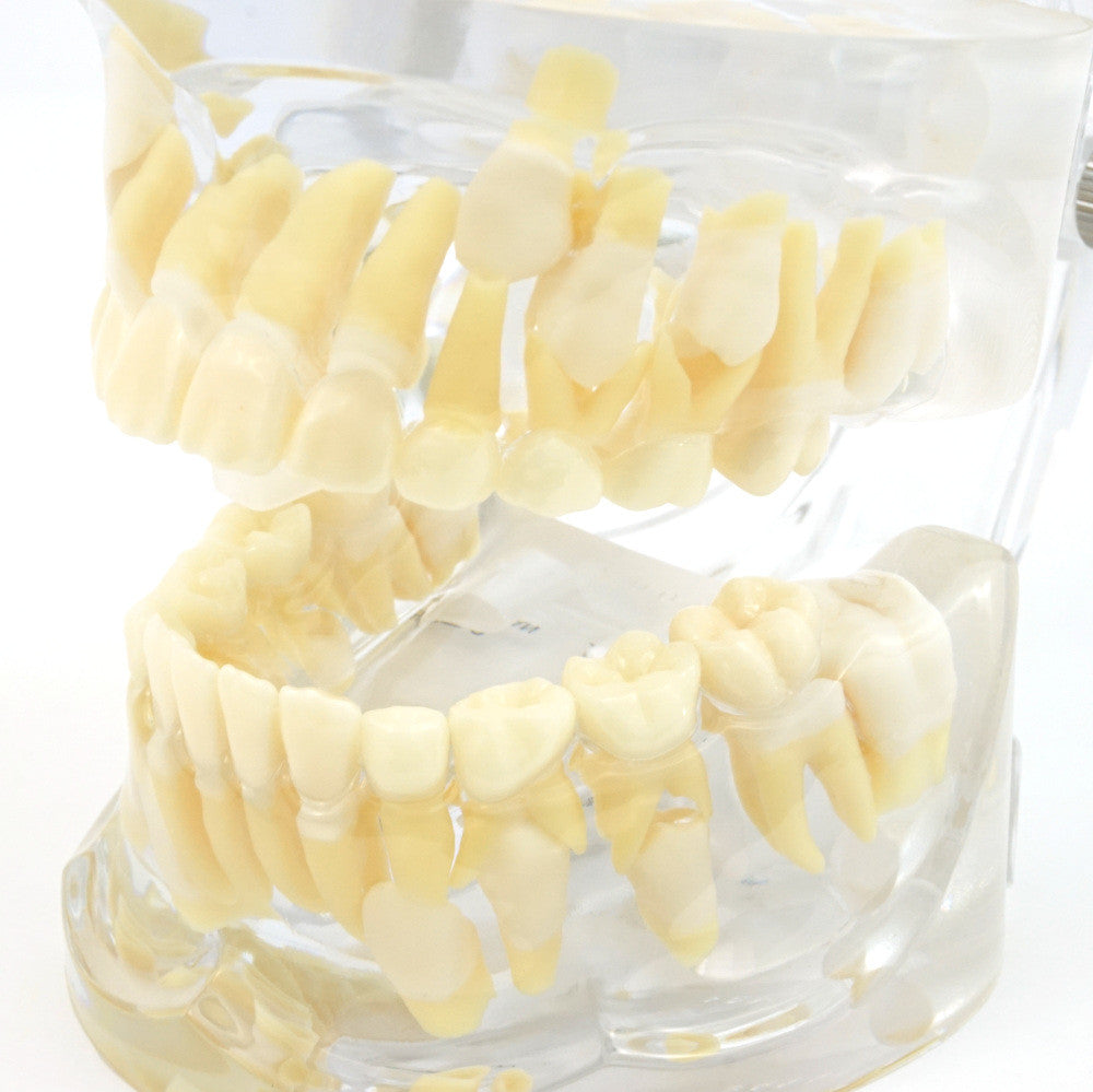 Mixed Dentition Model