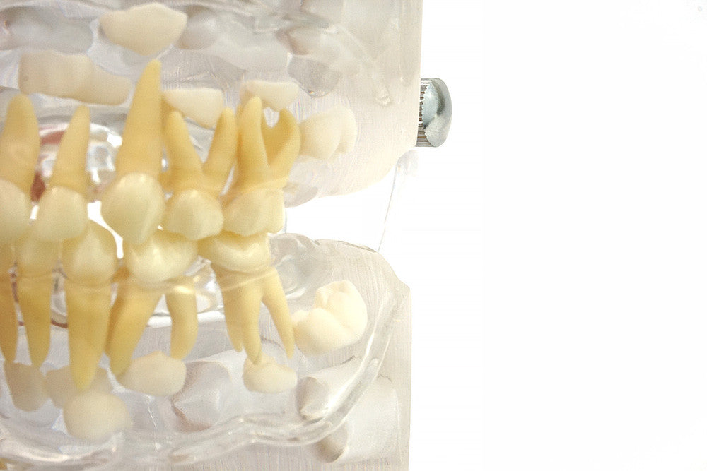 Primary Dentition Model