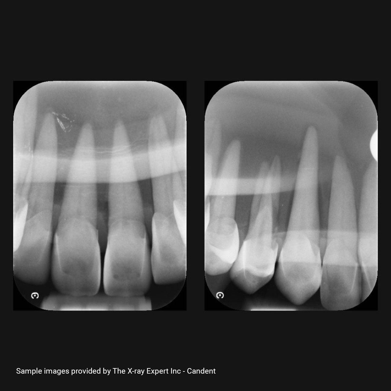 XR Artificial Radiographic Training System