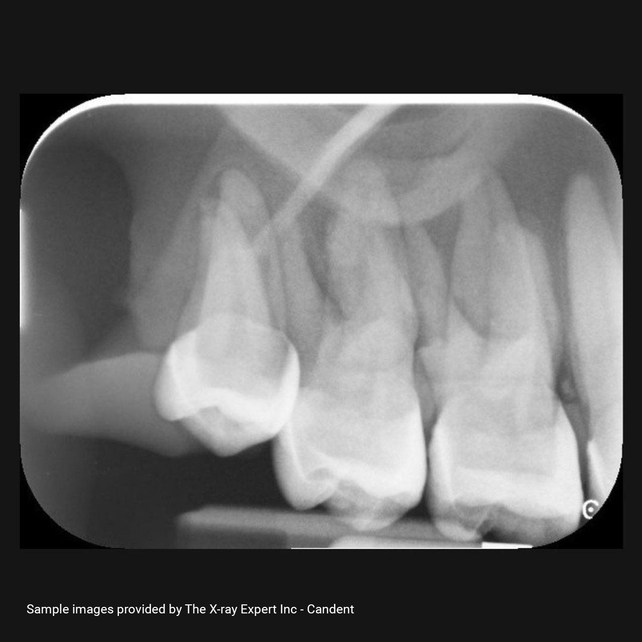 XR Artificial Radiographic Training System