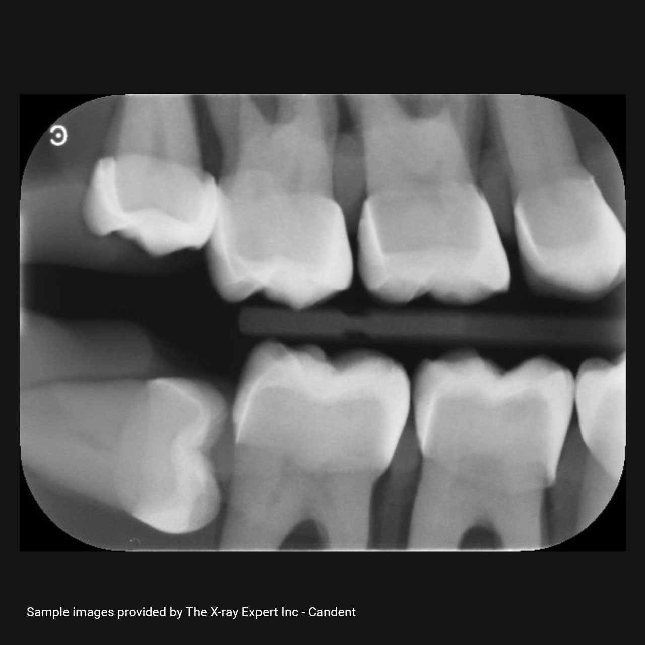 XR Artificial Radiographic Training System