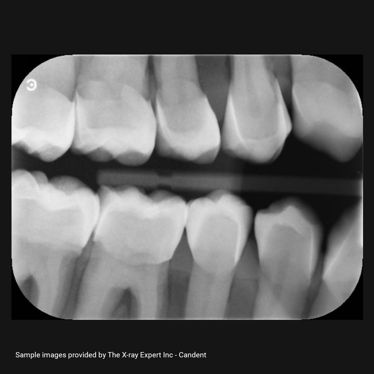 XR Artificial Radiographic Training System