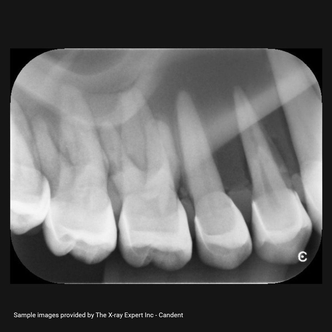 XR Artificial Radiographic Training System