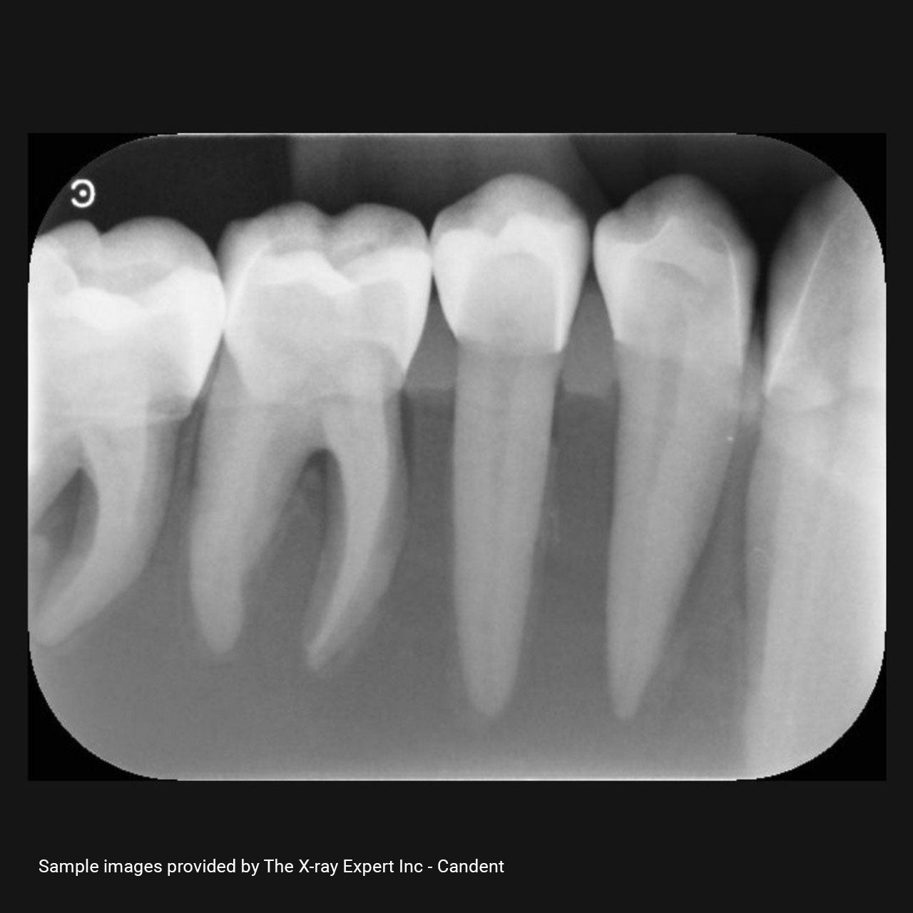 XR Artificial Radiographic Training System