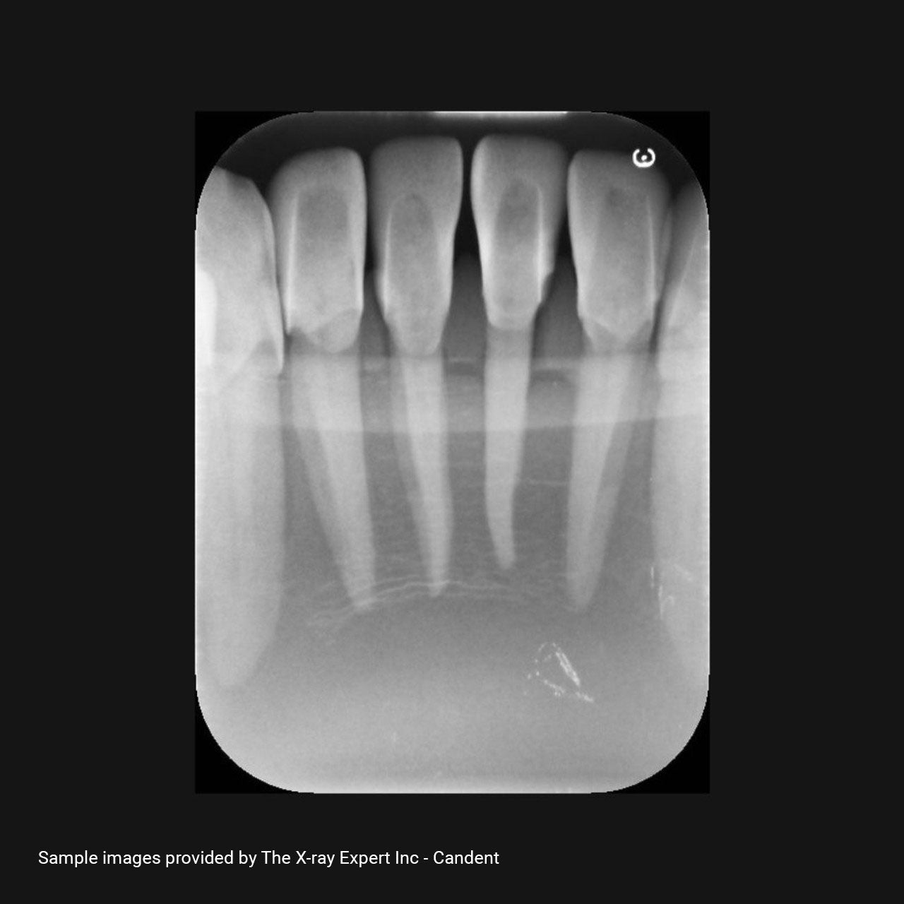 XR Artificial Radiographic Training System