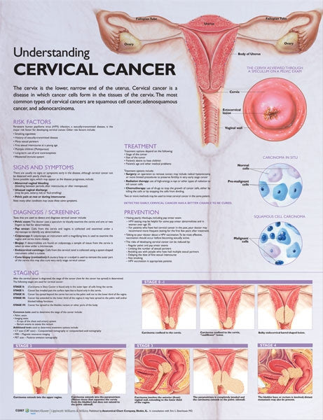Understanding Cervical Cancer