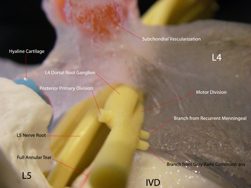 Professional LxH Disc Model