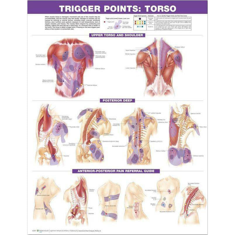 Trigger Point chart, Torso