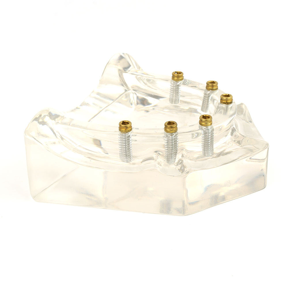 Overdenture model using 6 implant locators on an upper arch