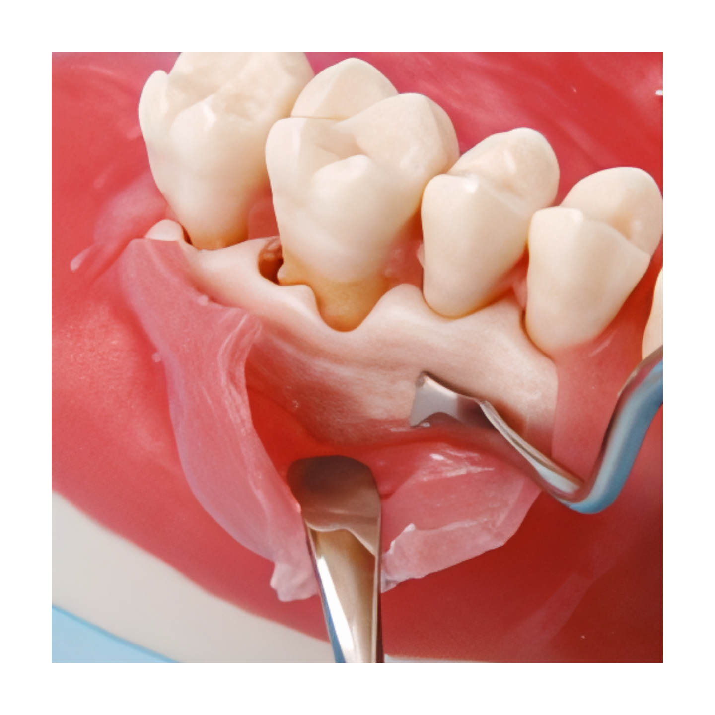 SUG1003 – Oral Surgery - Kilgore / Nissin SUG1003, view 5