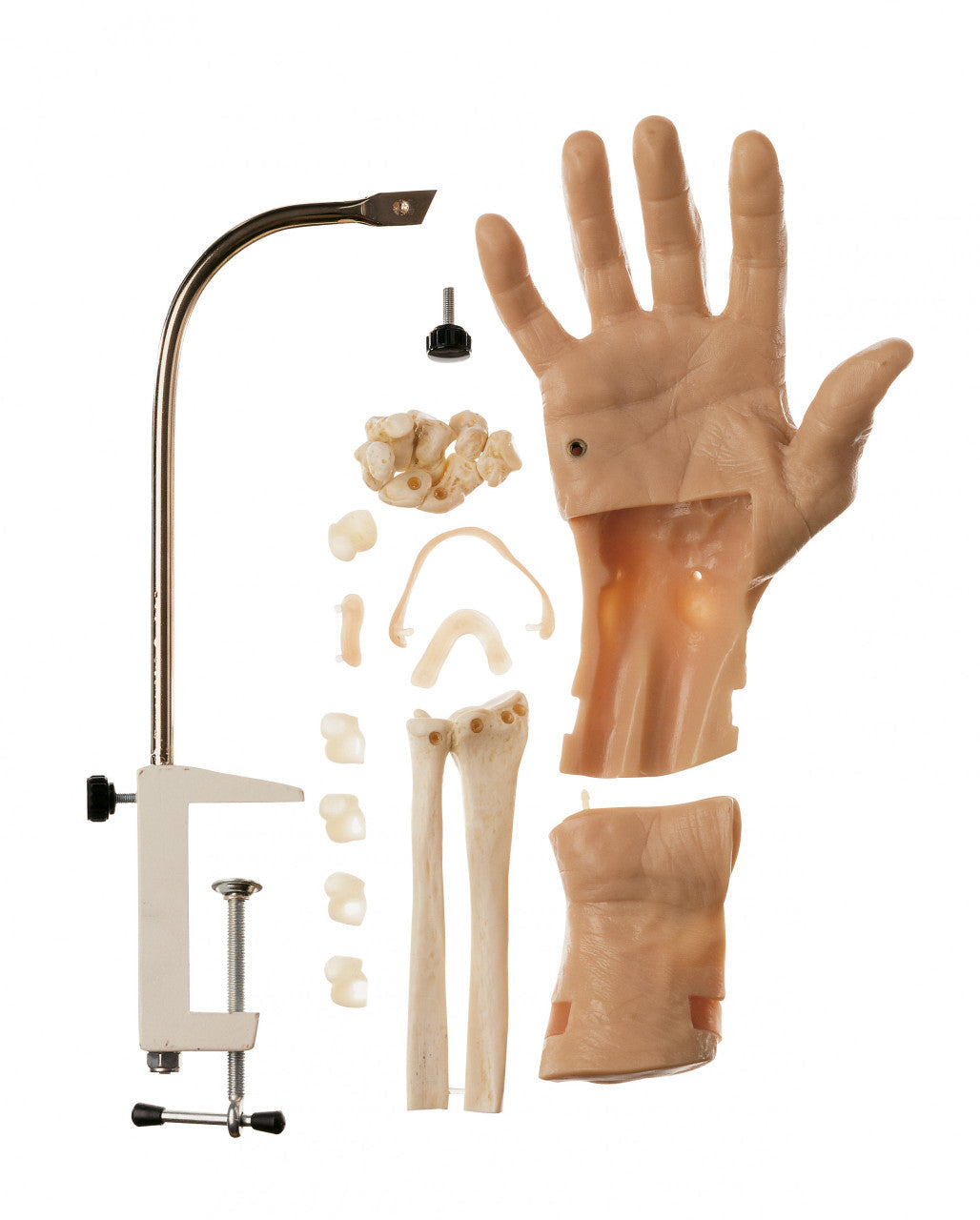 Arthroscopic Model of the Wrist