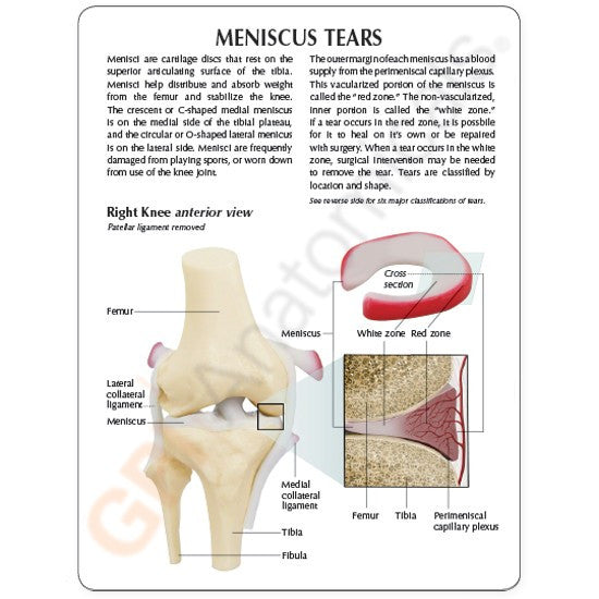 1010-meniscus-tears-rear__38506.1589753099.1280.1280.jpg