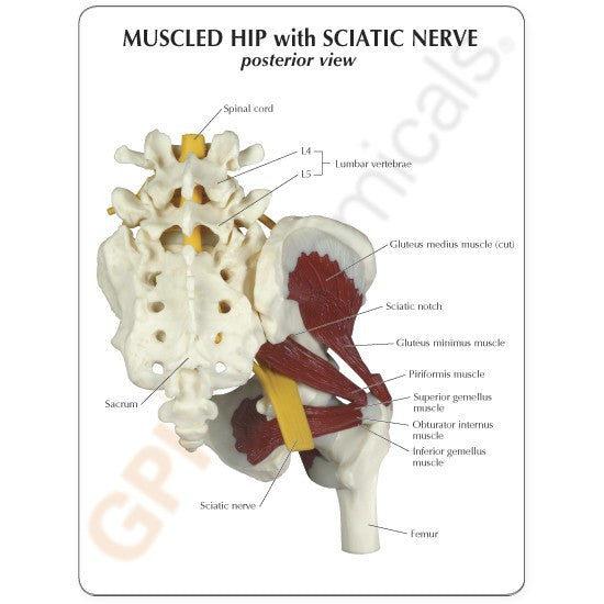 Muscled Hip with Sciatic Nerve - card
