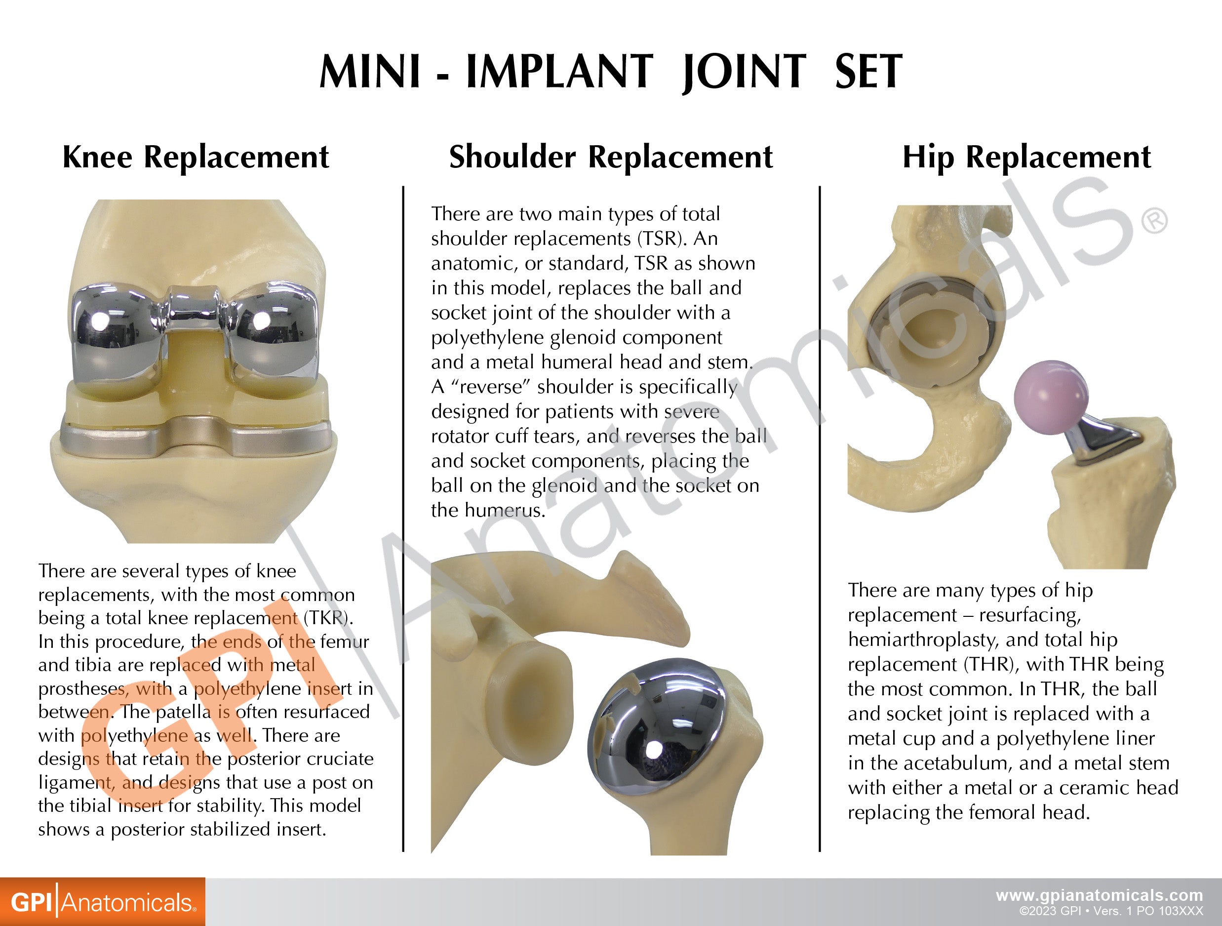 Mini-Implant Joint Set (NEW! Model)