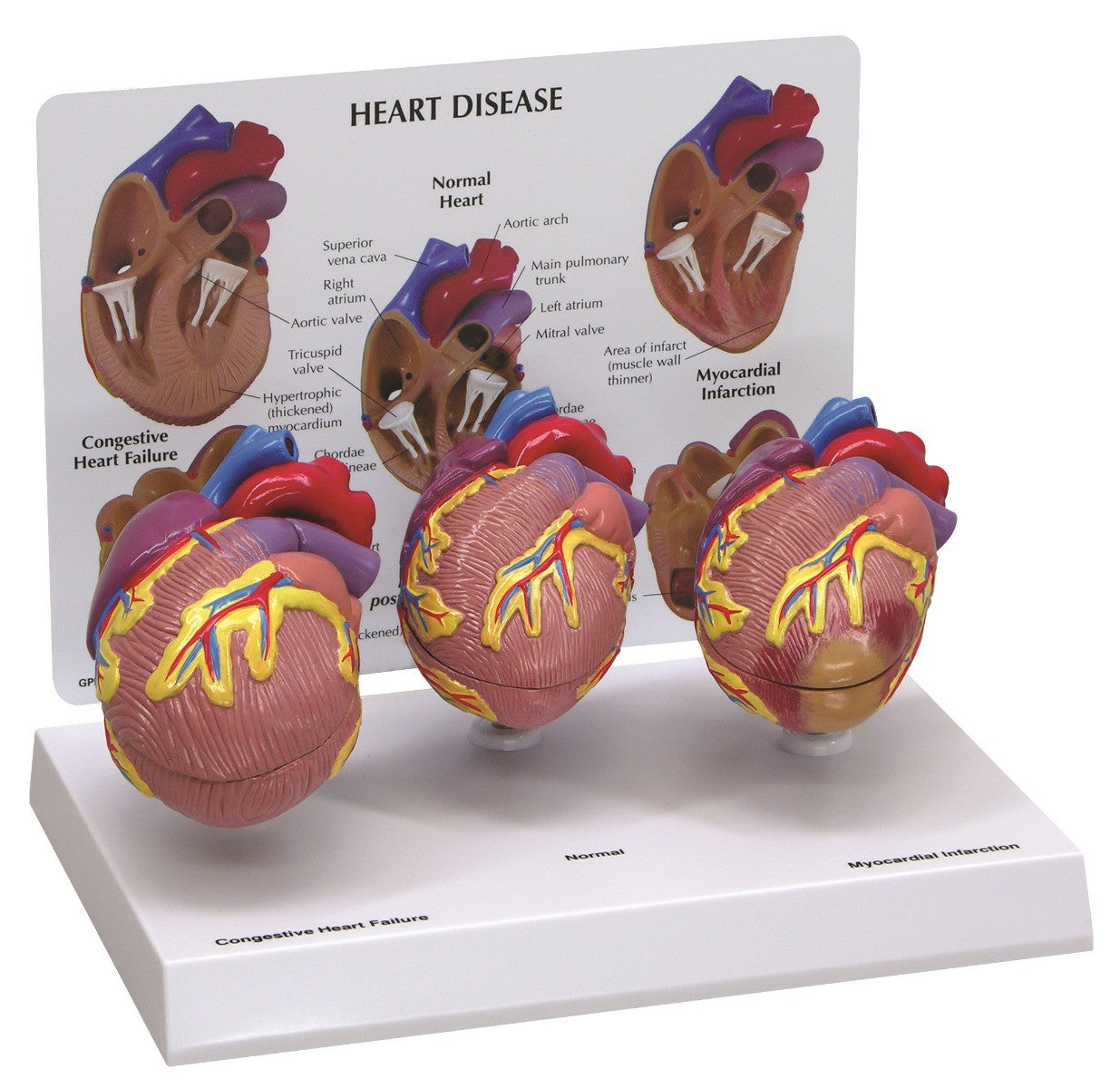 3 Mini Heart Set | GPI 2550