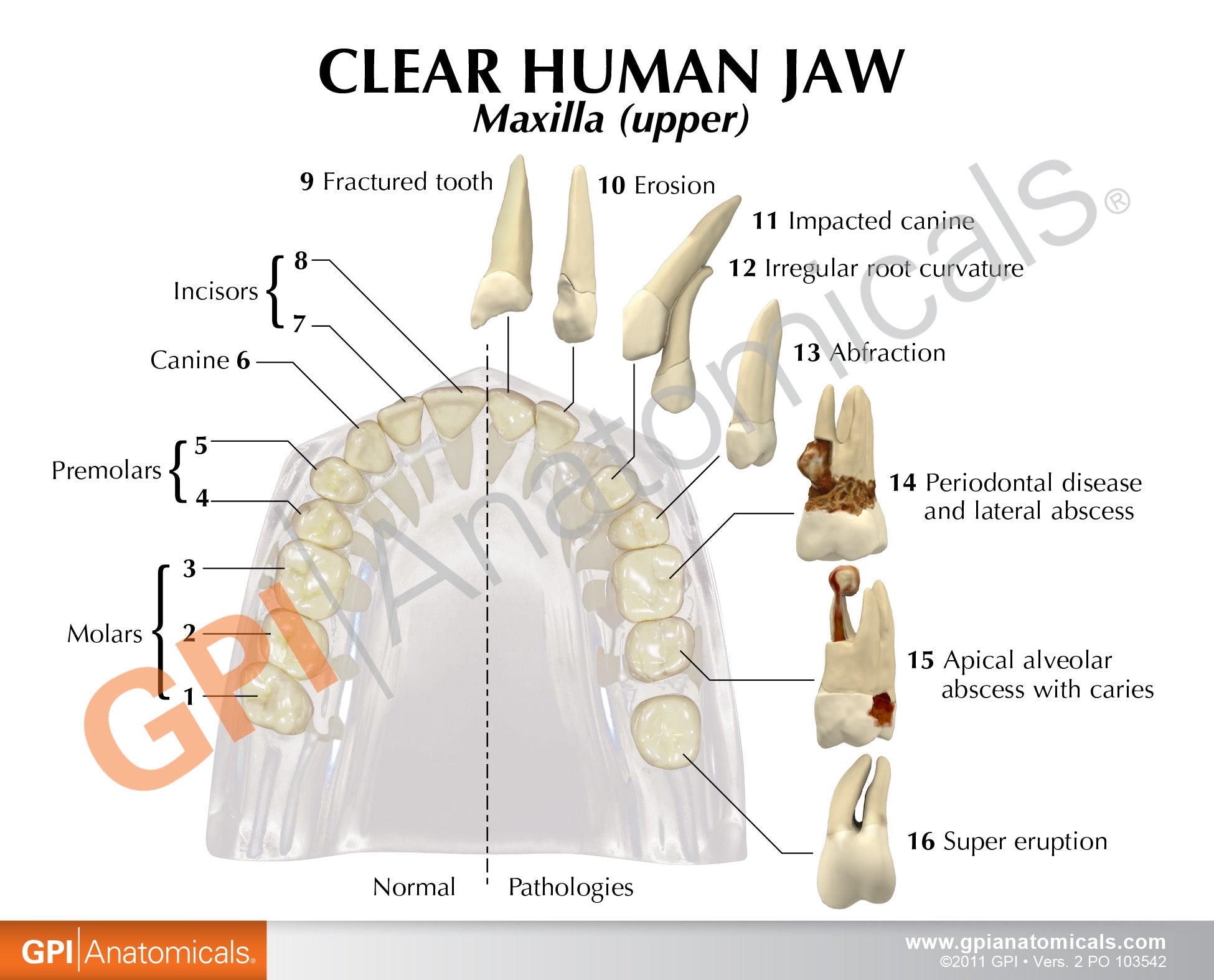 Clear Teeth (Healthy/Pathologies)
