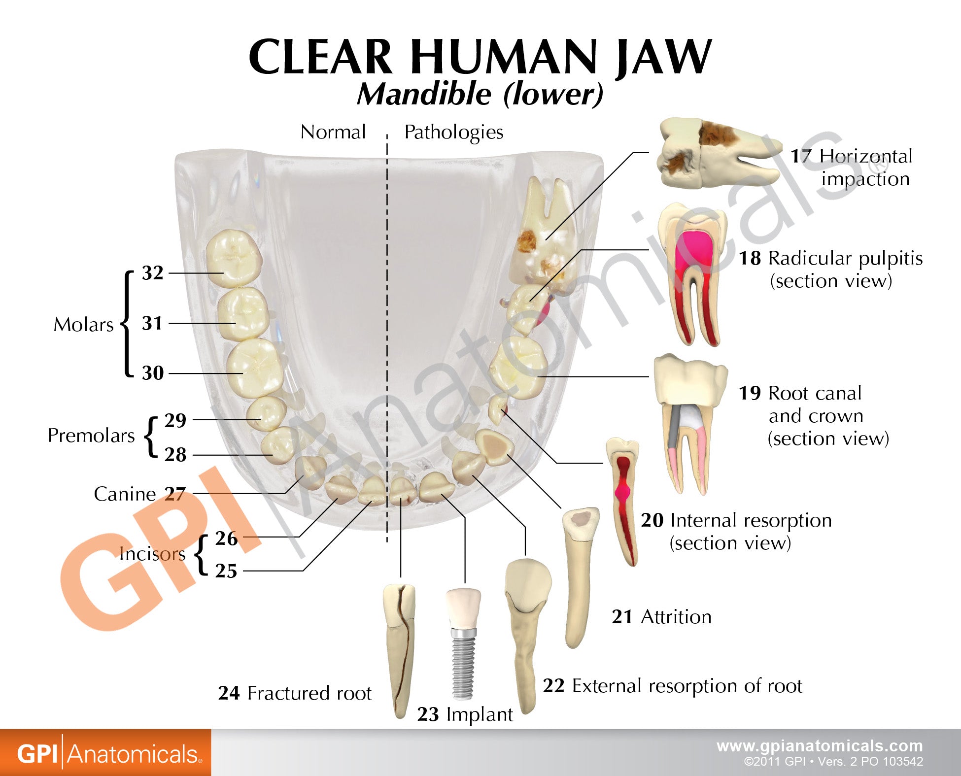 Clear Teeth (Healthy/Pathologies)
