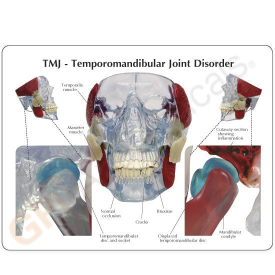 TMJ Model card