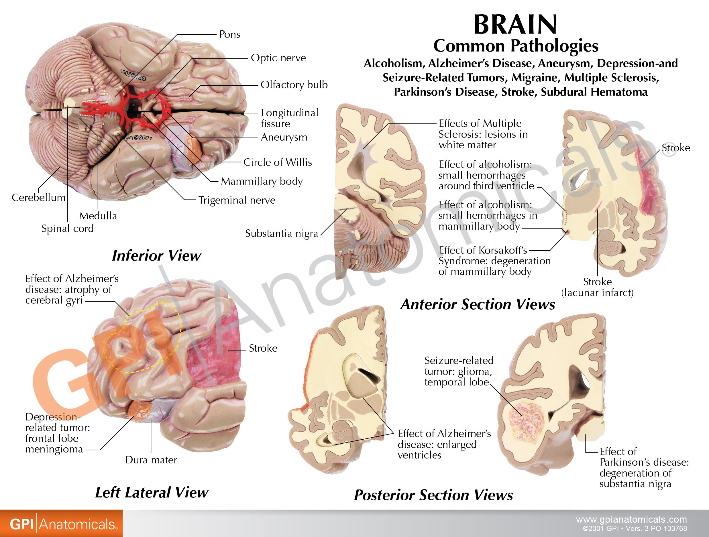 Brain in Base of Skull