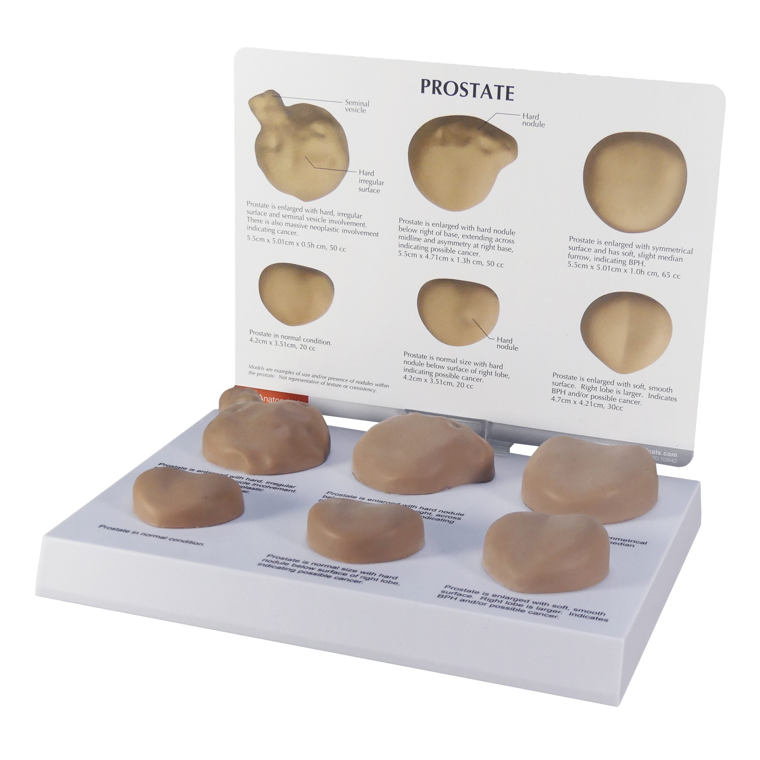 Prostate model set