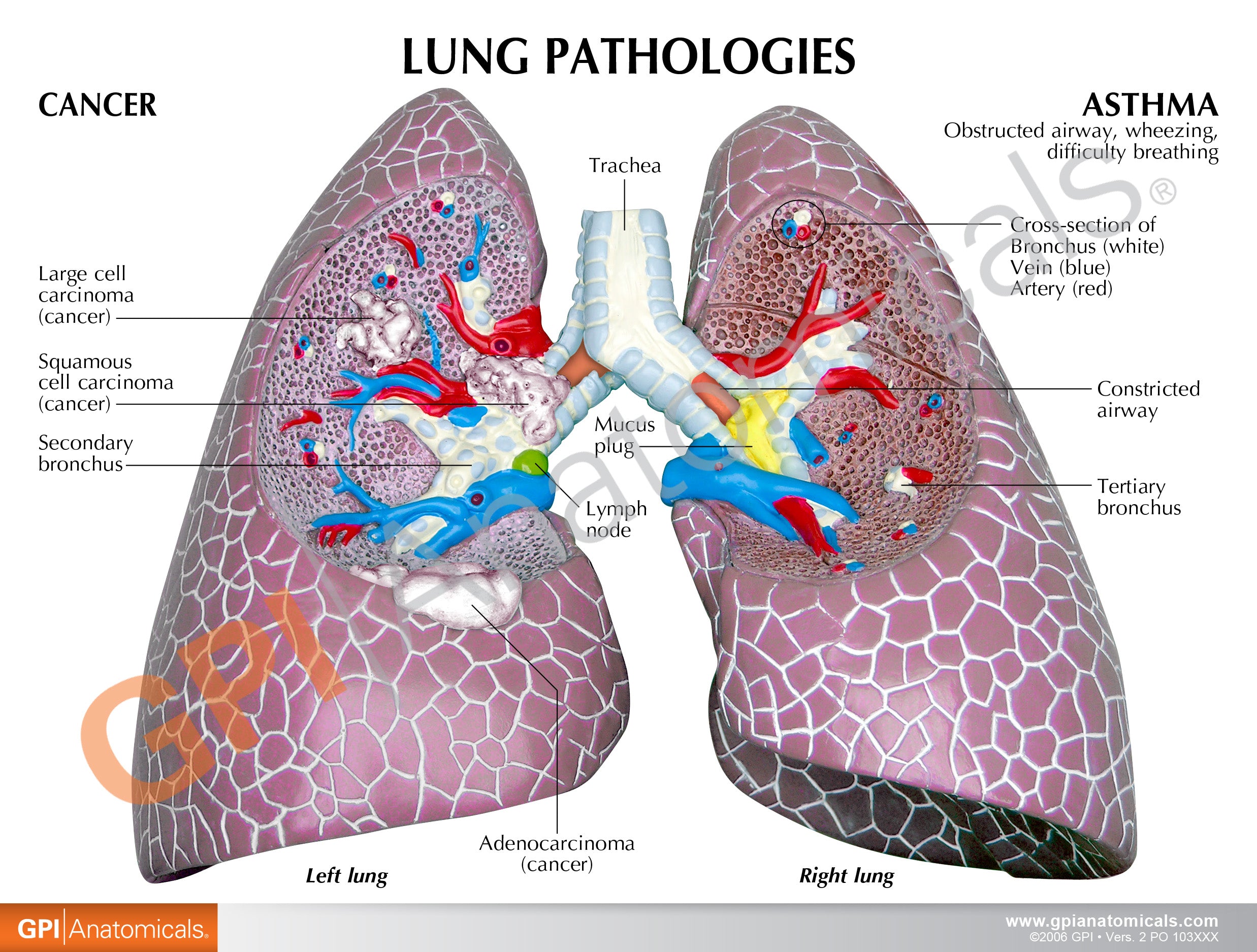 Lung Set (with Pathologies)