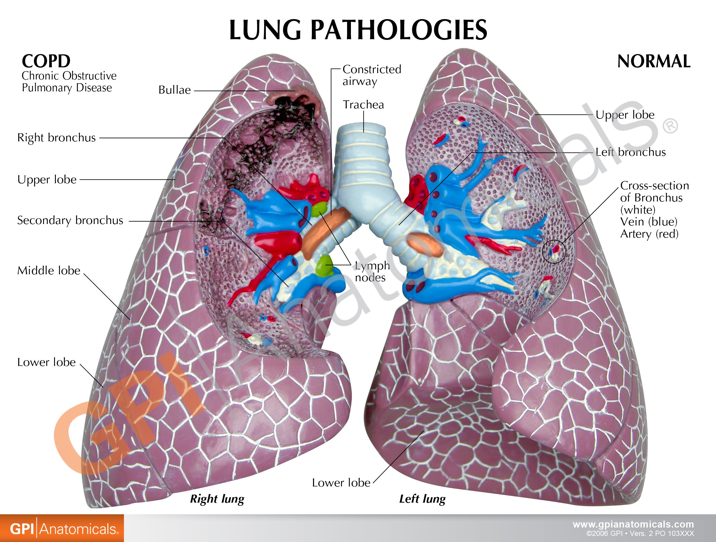 Lung Set (with Pathologies)