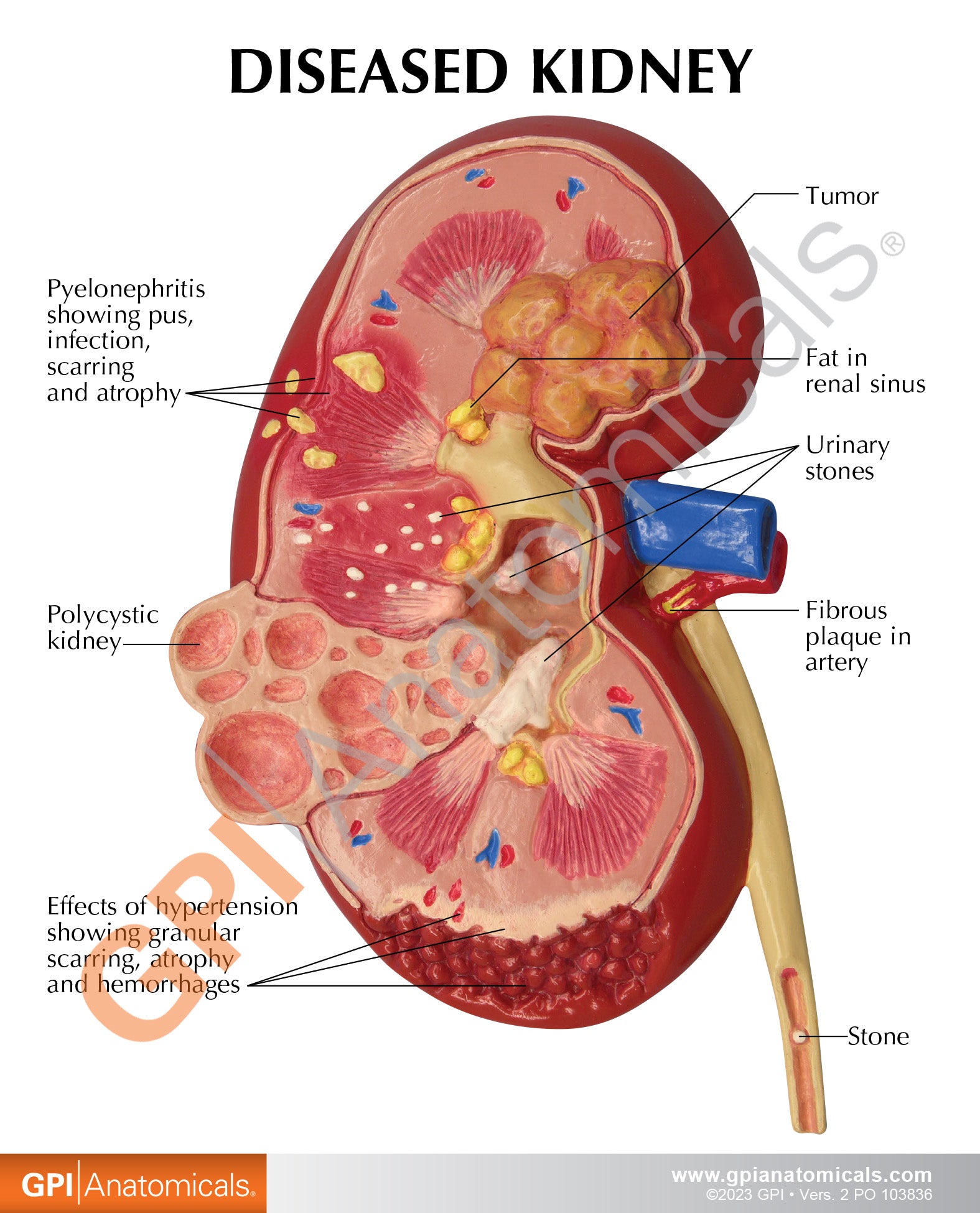 Kidney (Normal/Pathologies)
