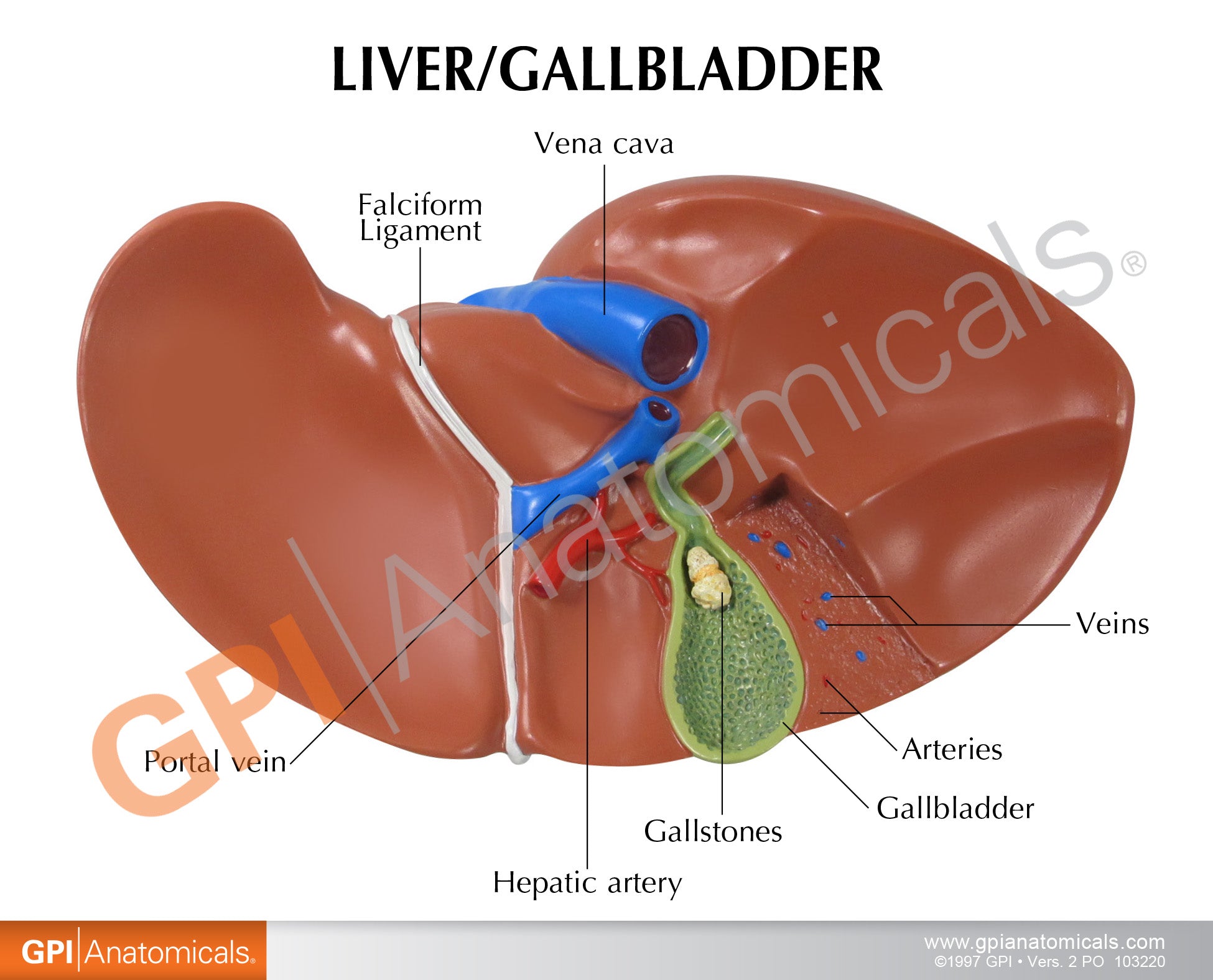 Liver/Gallbladder (with Gallstones)