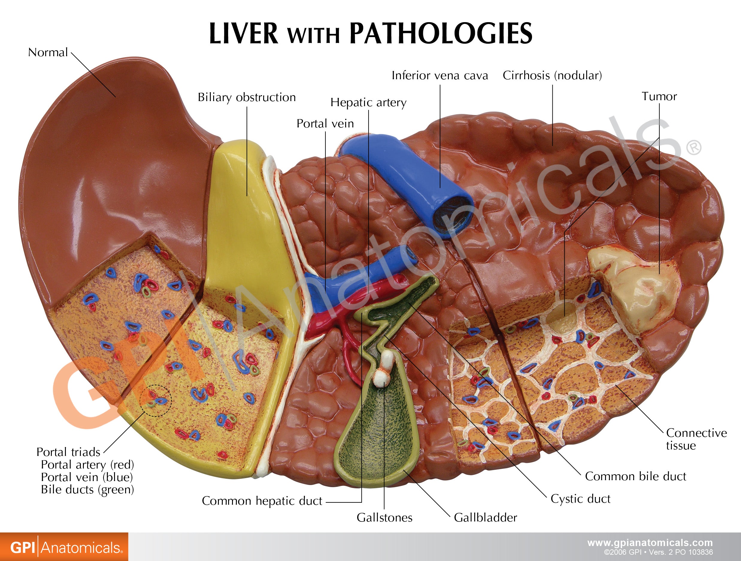 Liver (with Pathologies)