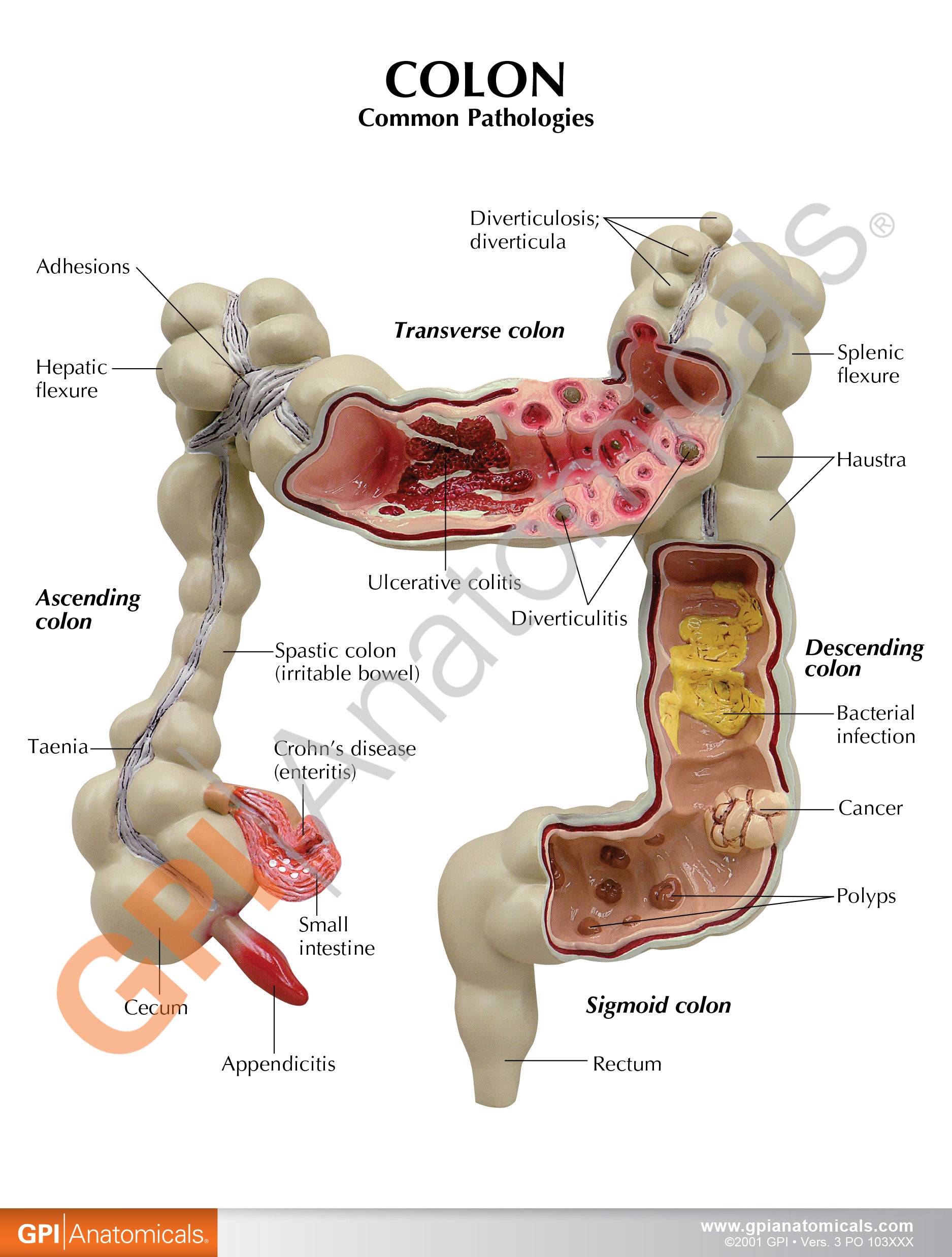 Colon