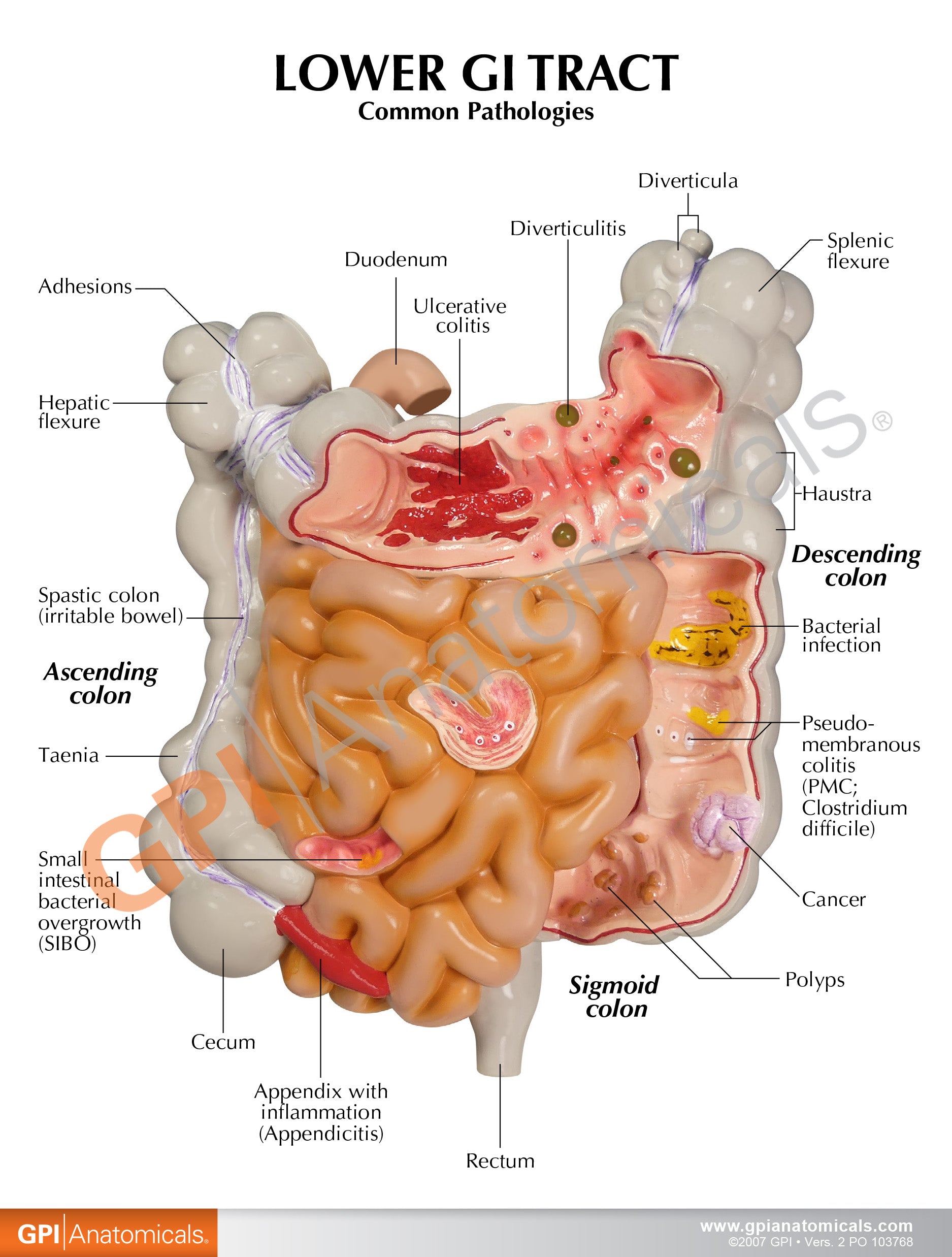 GI Tract