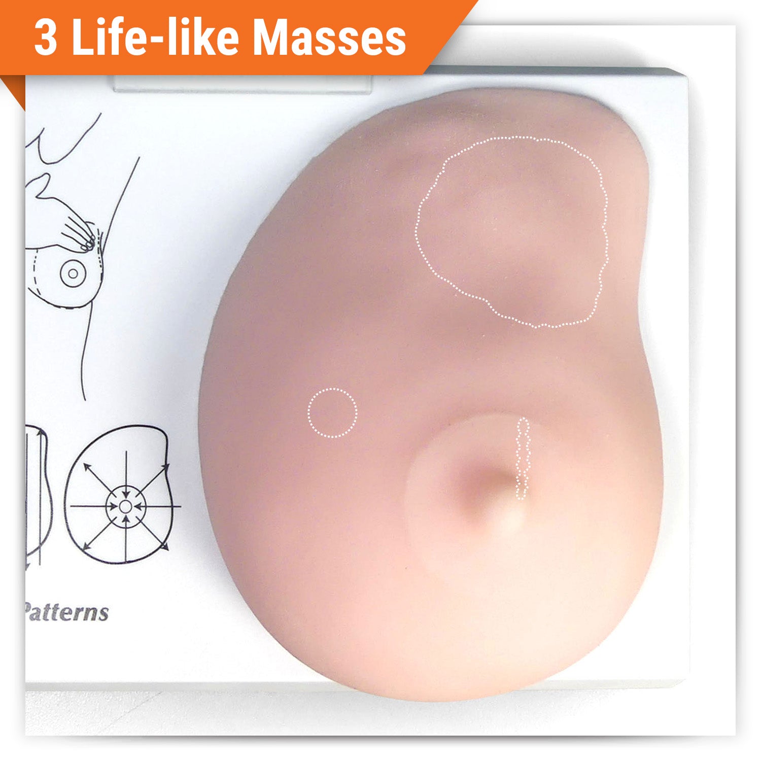 Left Breast (with Irregular Masses)