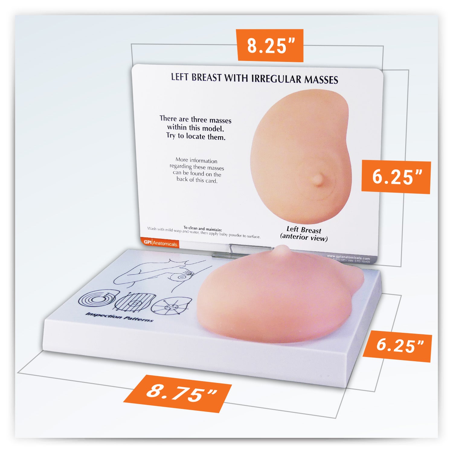 Left Breast (with Irregular Masses)