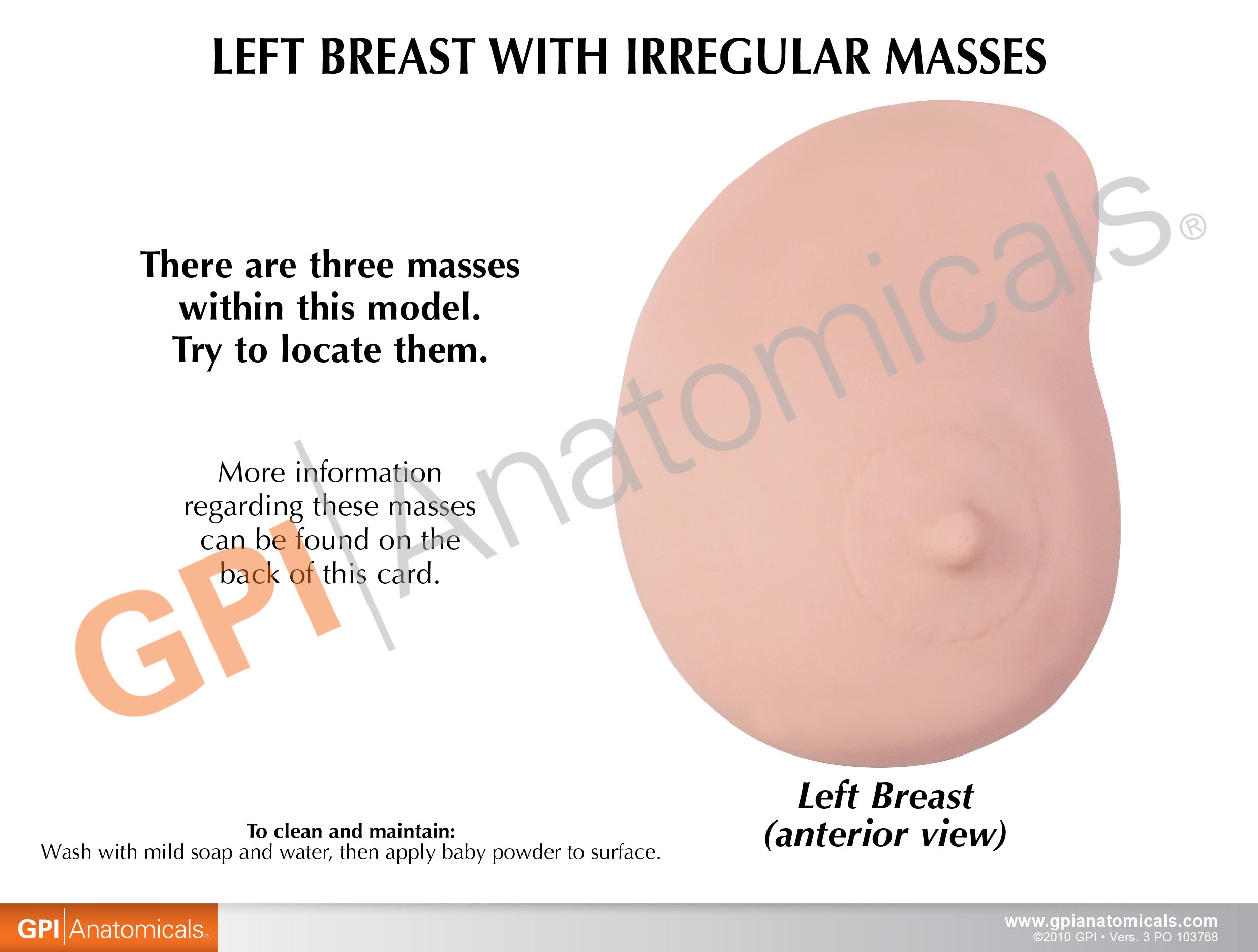 Left Breast (with Irregular Masses)