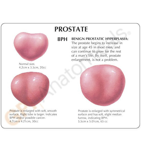 3550-prostate-rear__10017.1589753155.1280.1280.jpg