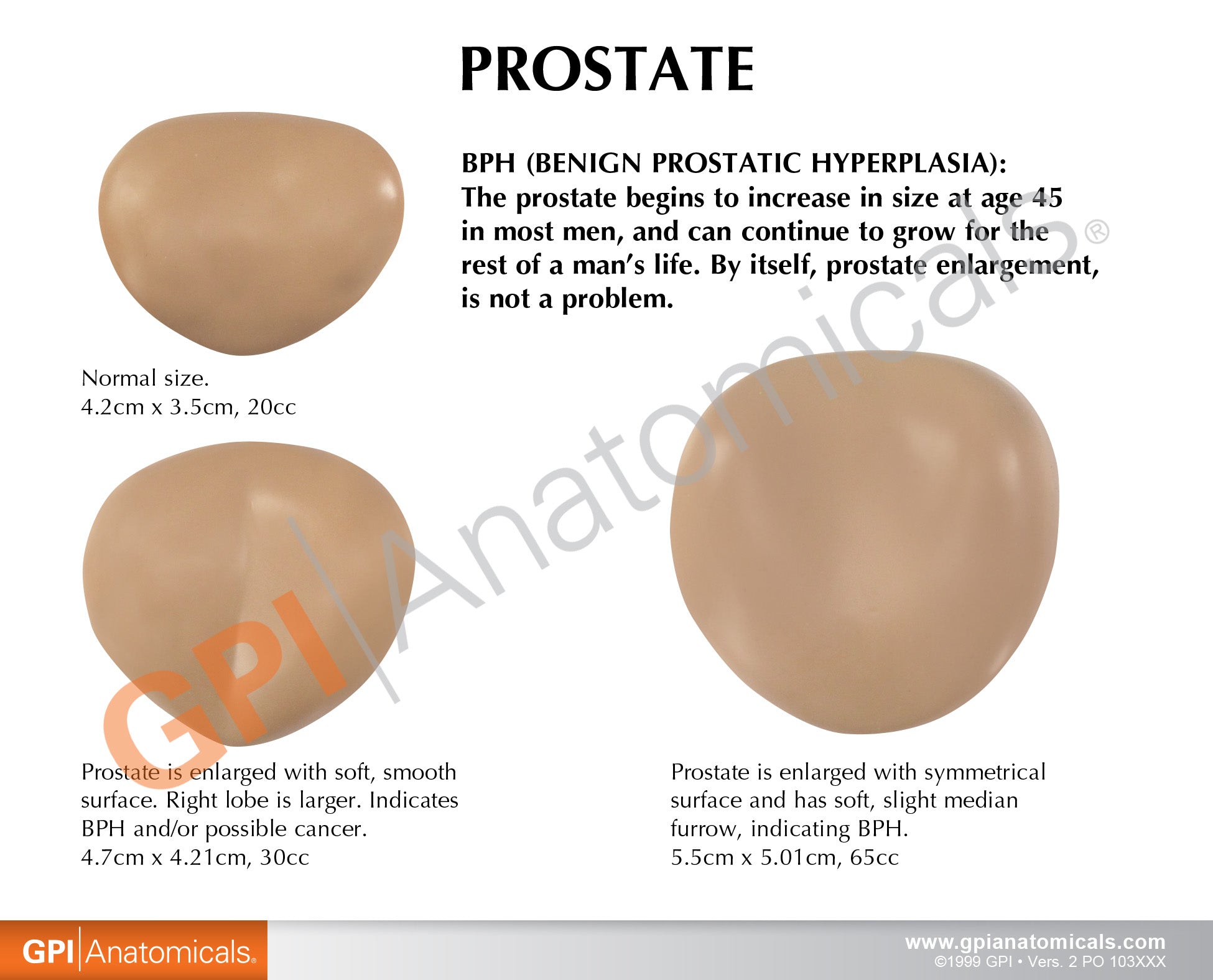 Male Pelvis with Prostate